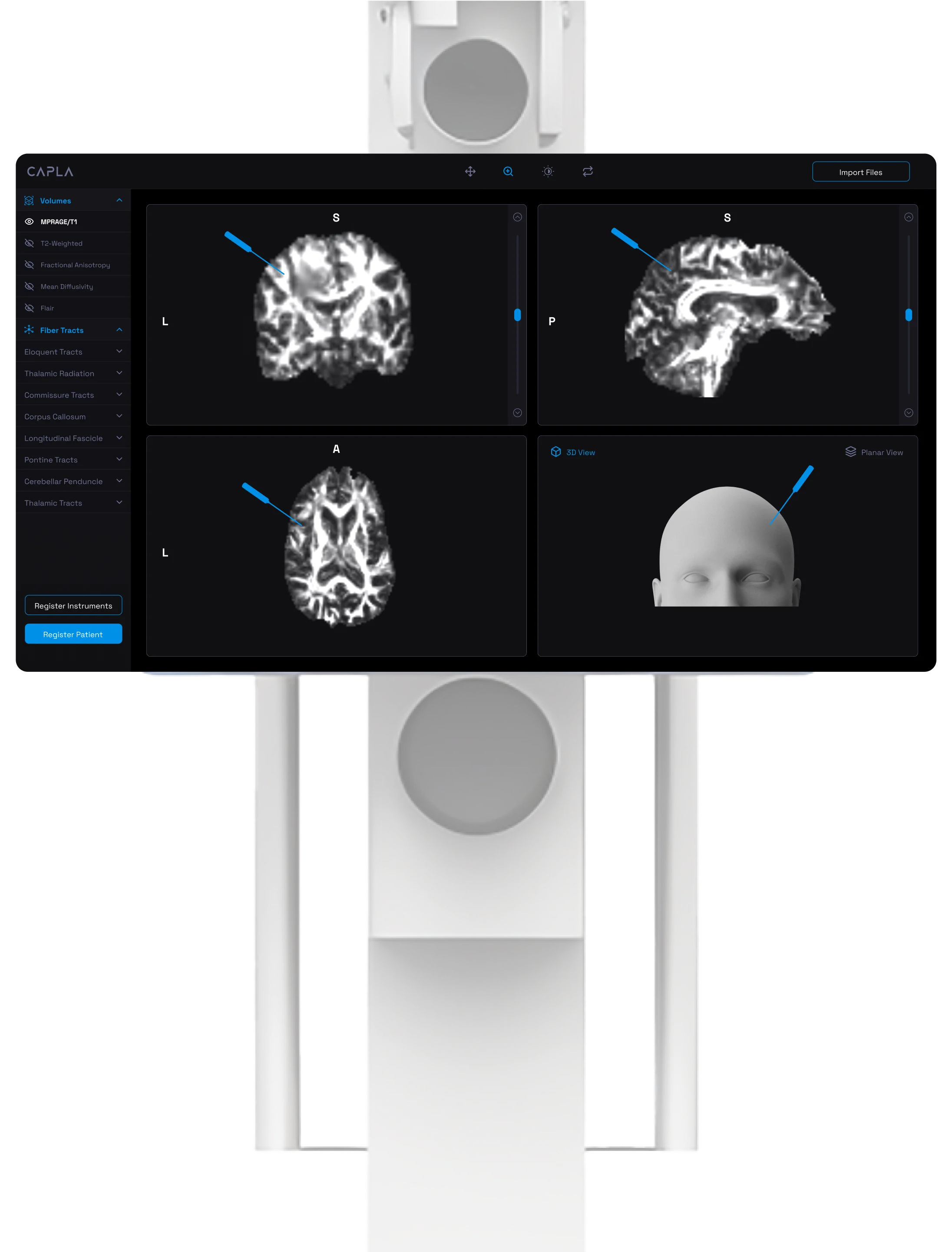 Capla Outcome background image